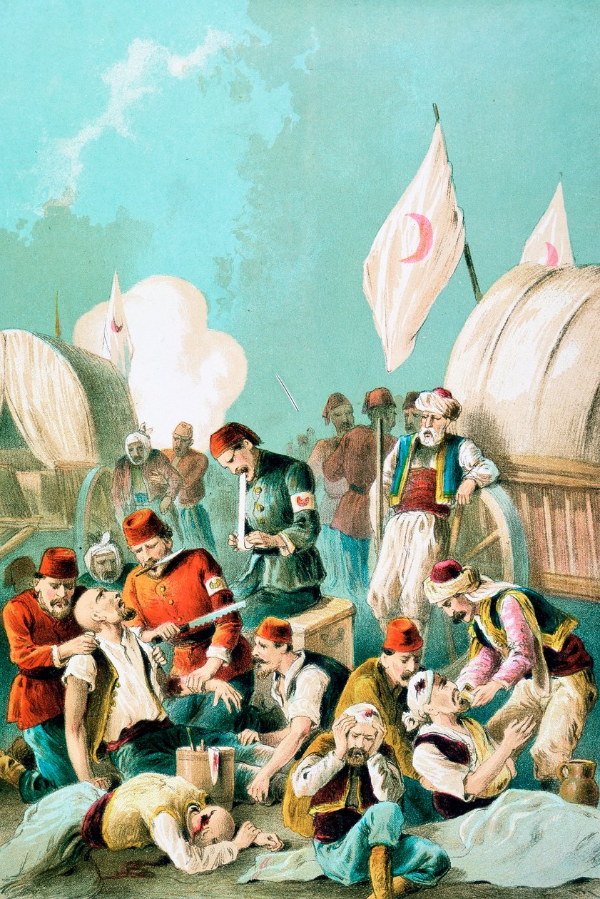بتر الذراع بدون مخدر ، الحرب الروسية التركية ، 1877 بواسطة غير معروف