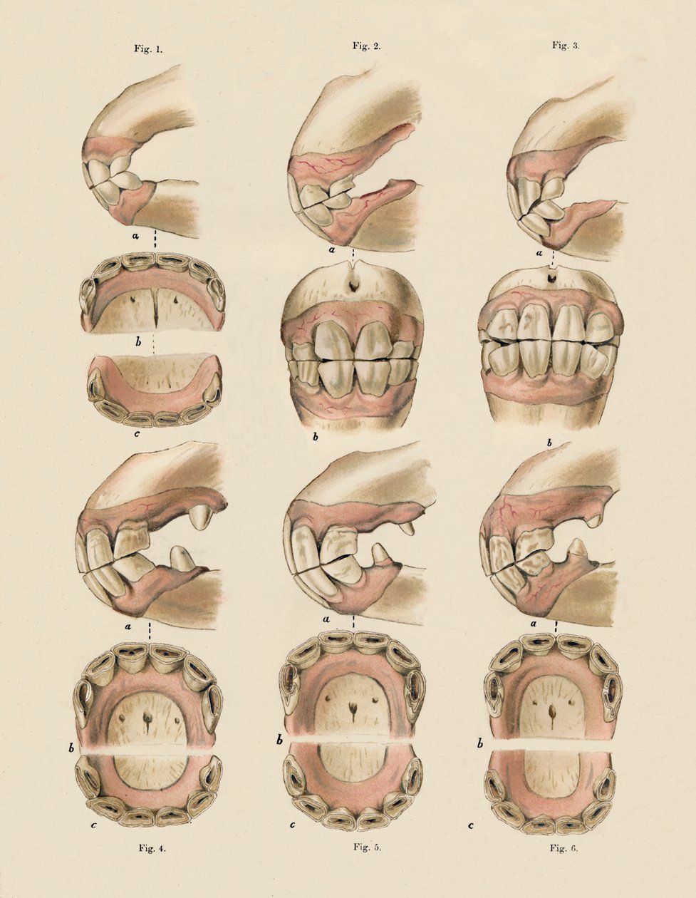 وصف لوحة تبين العمر ، كما يتضح من الأسنان ، c1879. بواسطة غير معروف