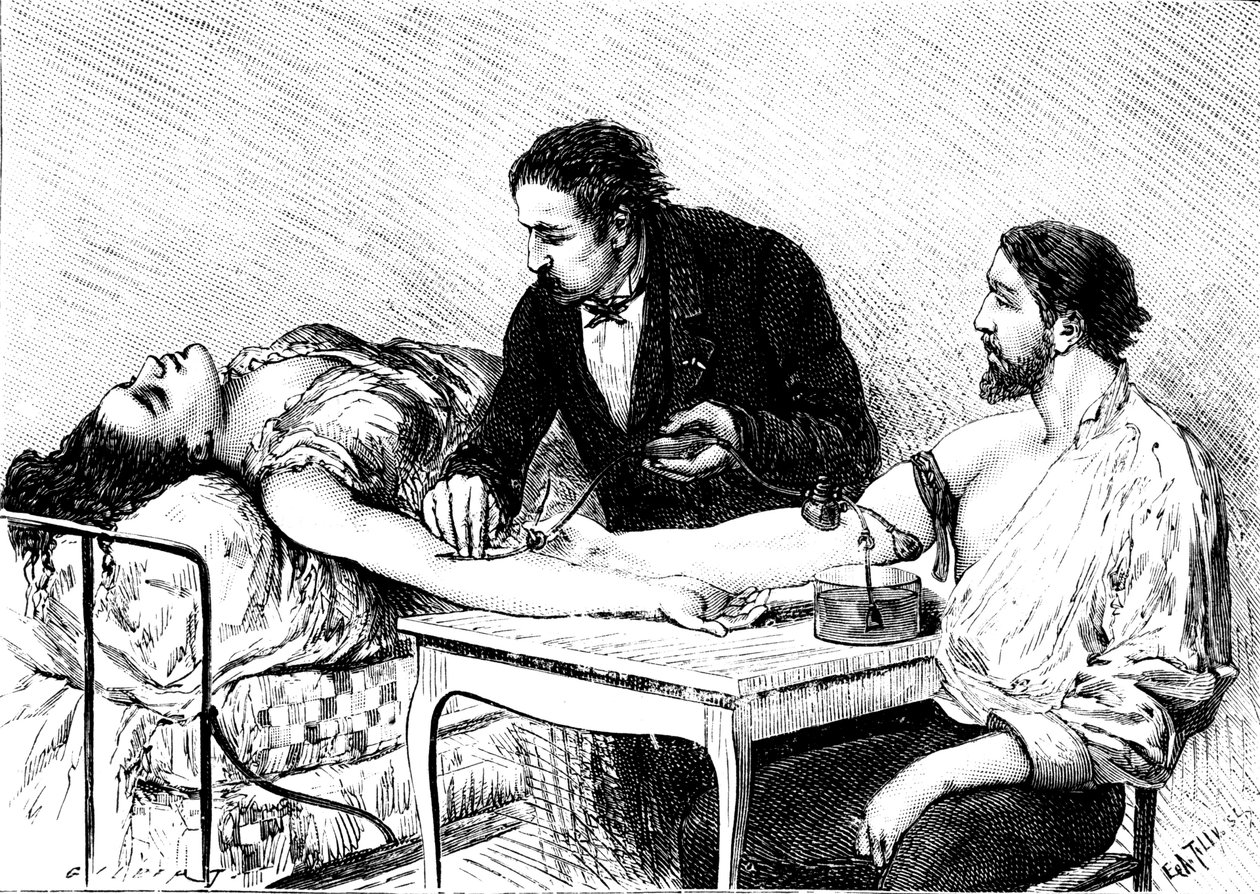 الدكتورة روسيل من جنيف تعطي امرأة نقل دم مباشر من متطوع ، 1882 بواسطة غير معروف