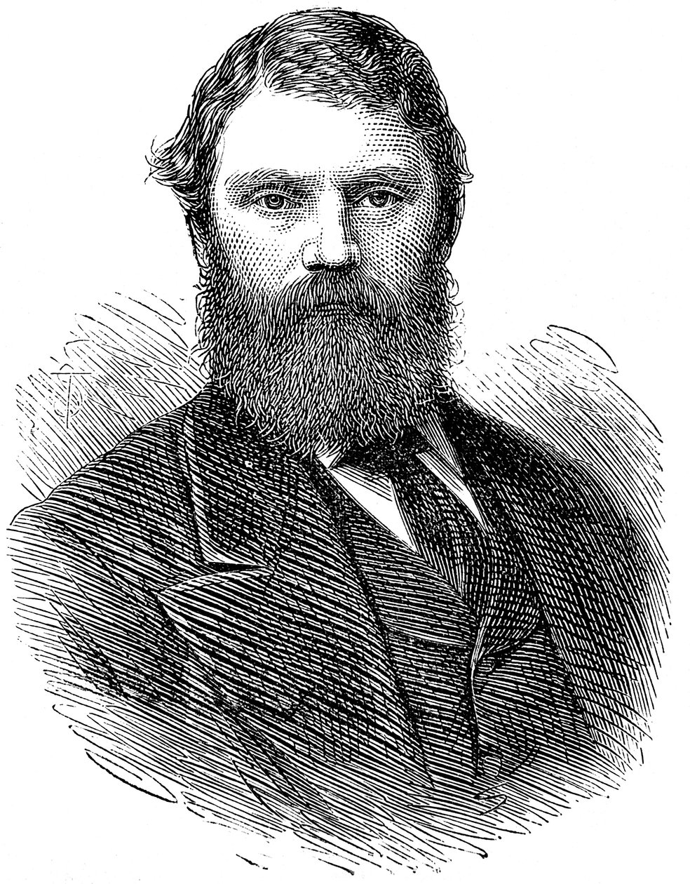 فرانسيس إدموند أنستي 1833-1874 ، طبيب إنجليزي ، 1874 بواسطة غير معروف