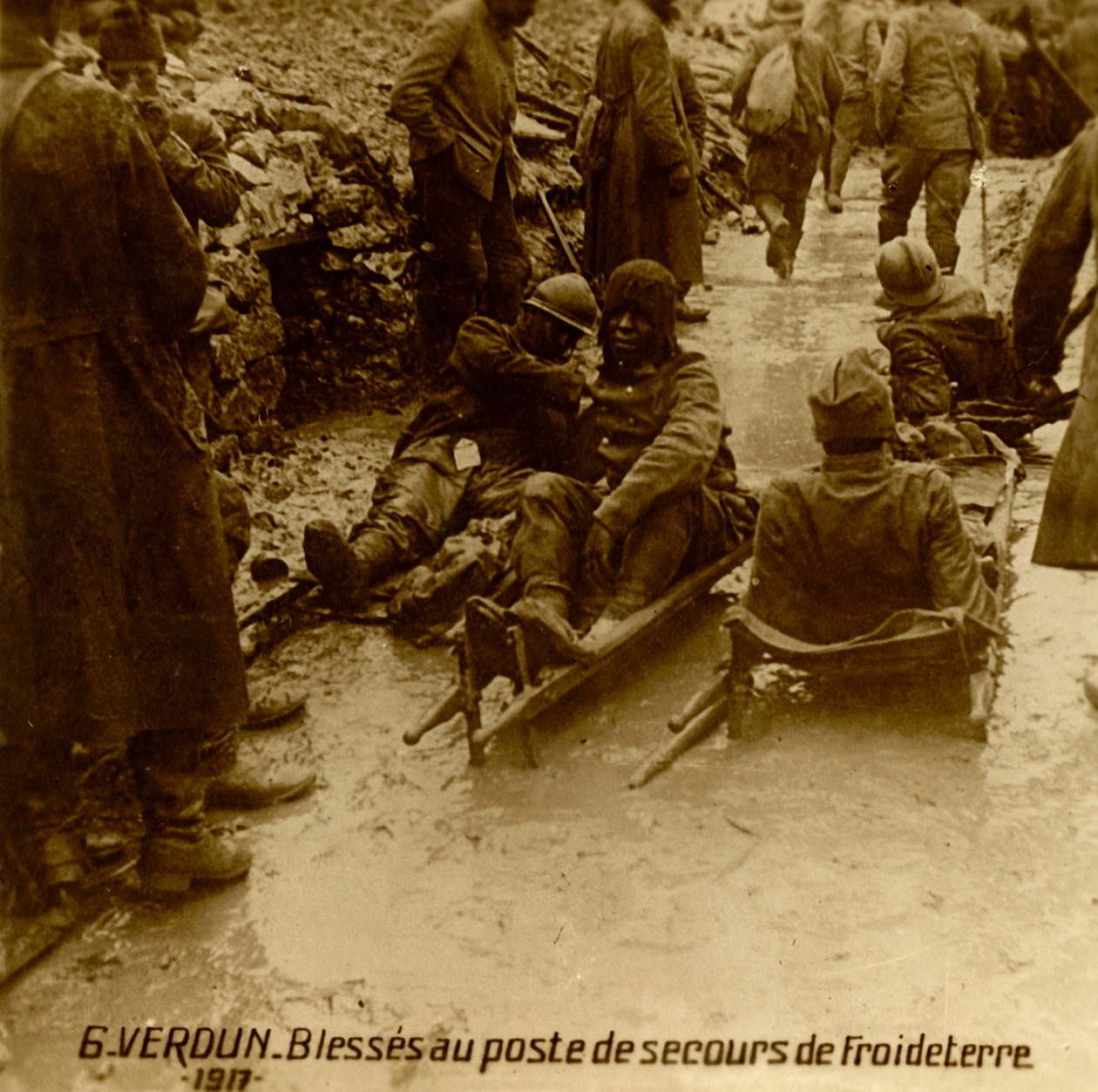 جنود مصابون في مركز الإسعافات الأولية ، فرويدتير ، فردان ، شمال فرنسا ، 1917 بواسطة غير معروف