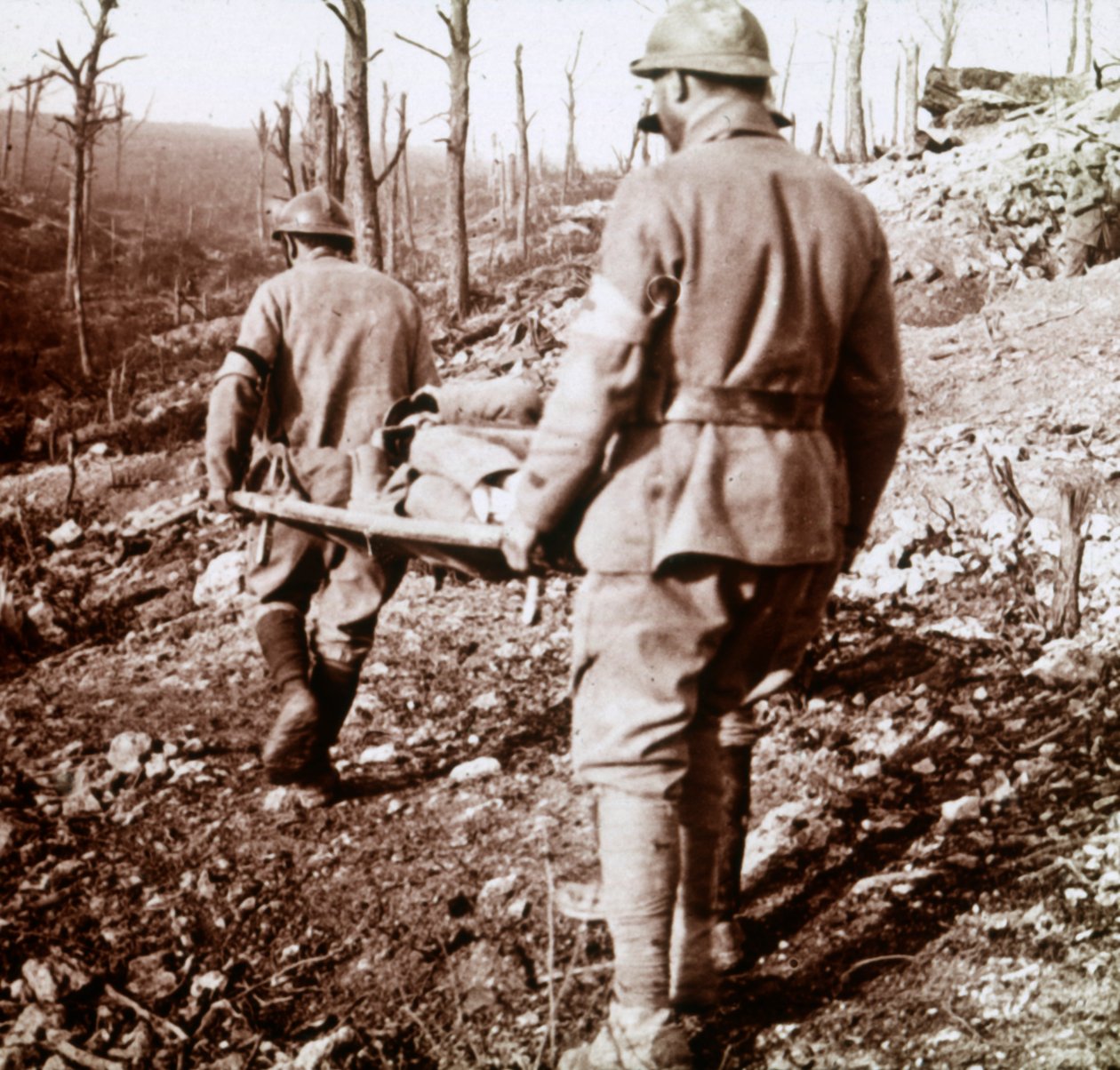 نقل الجرحى ، Chemin des Dames ، شمال فرنسا ، c1914-c1918. بواسطة غير معروف