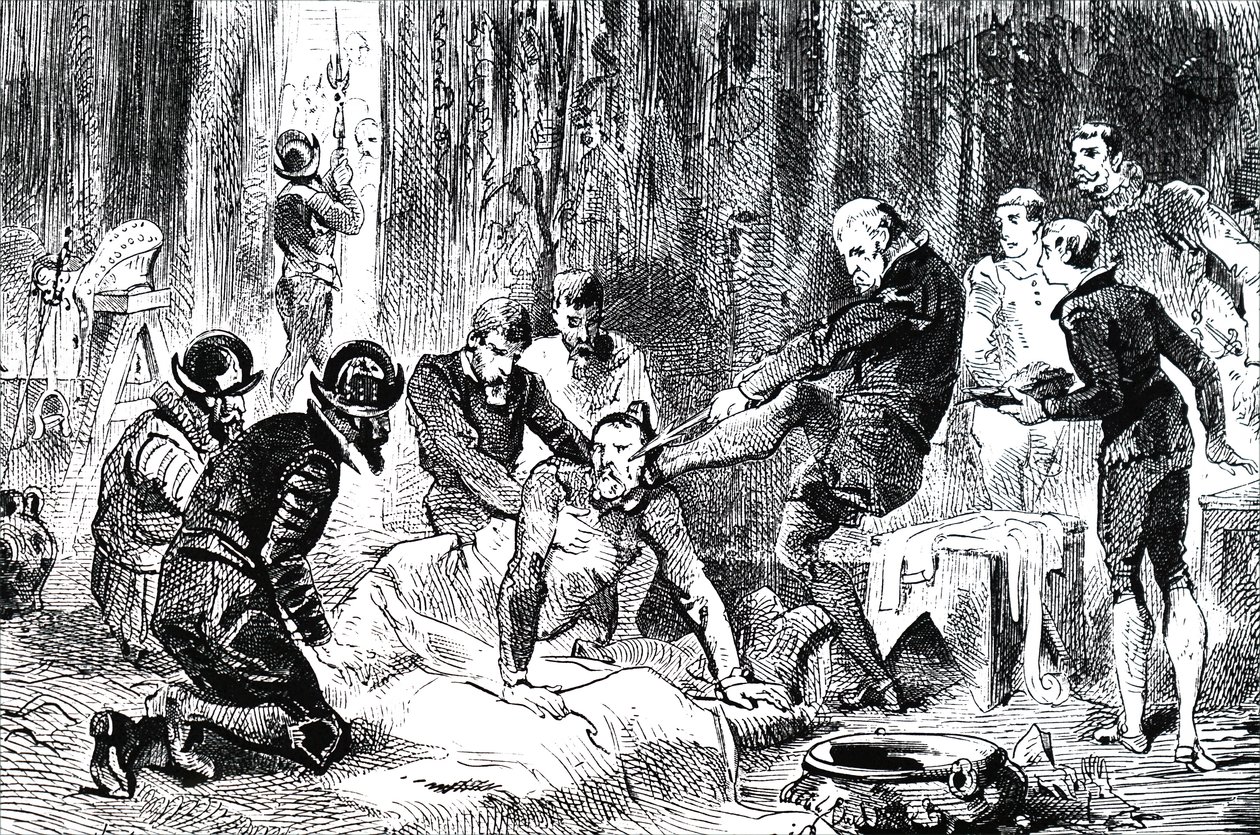 Ambroise Pare يزيل رمح من وجه Duc due Guise. بواسطة غير معروف