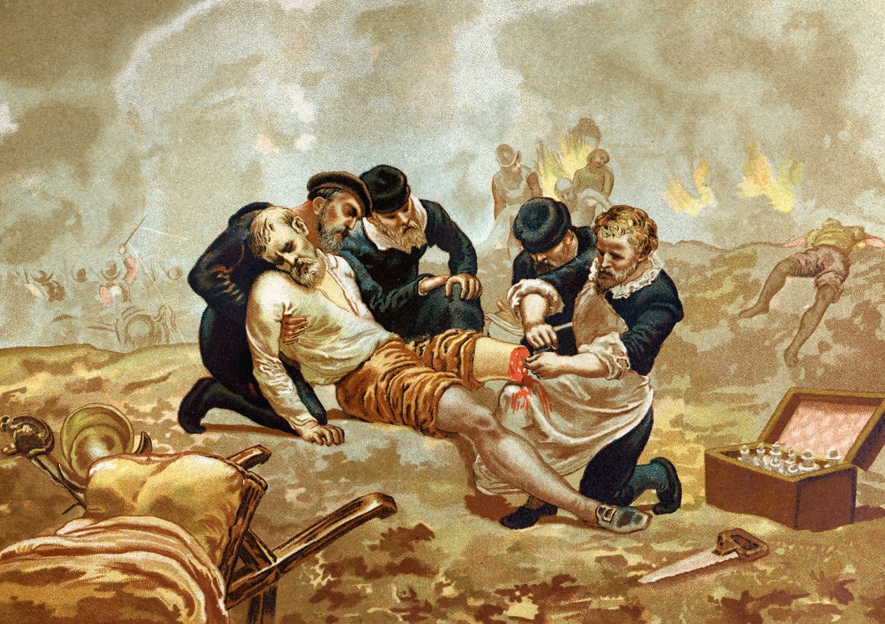 يمارس Ambroise Pare Medicin والجراح الفرنسي (1509-1590) ربط الشرايين بعد البتر. بعد احتفالات hombres y Mujeres. برشلونة 1877. بواسطة فنان غير معروف