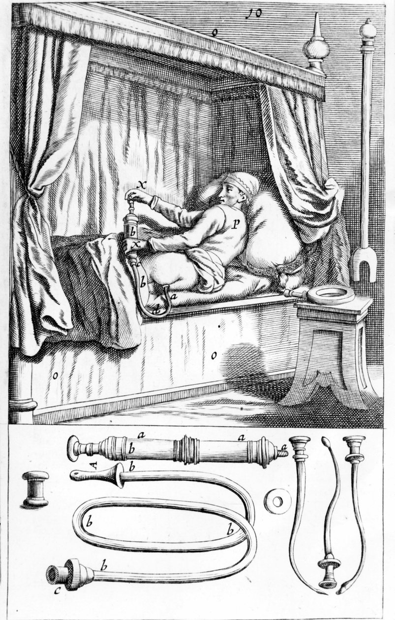 كليستير (للحقن الشرجية) بواسطة يوهانس سكلبتتوس "" Armamentarium Surgical "". البندقية 1665 بواسطة فنان غير معروف
