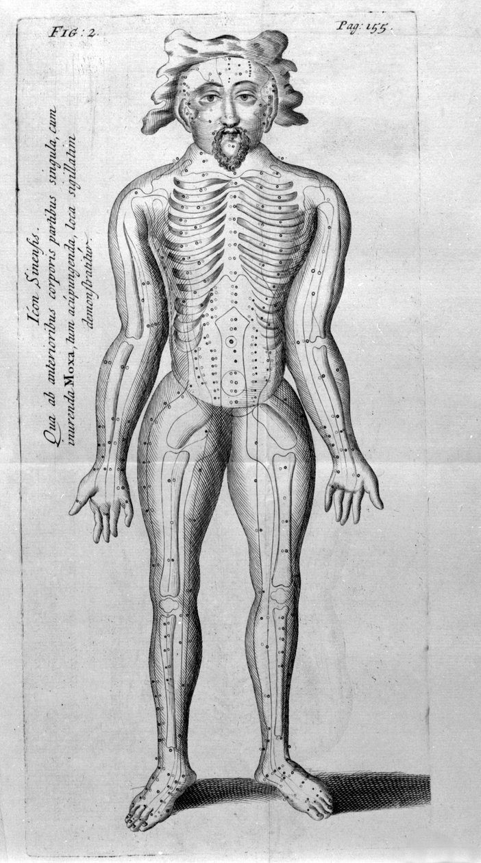 De Acupunctura بواسطة W.Ten Rhijne. لندن 1683. أول نص غربي يعالج الوخز بالإبر. بواسطة فنان غير معروف