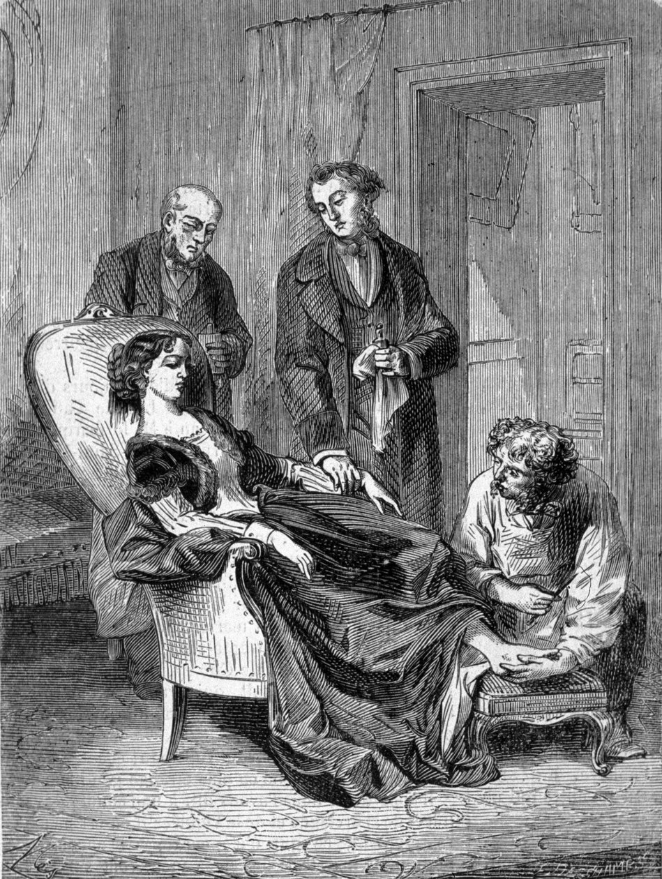مقتطفات للفتاة حنا غرينر في الخامسة عشرة من عمرها بعد أول تخدير بالكلوروفورم بتاريخ 28/1/1848. نقش من عام 1869. بواسطة فنان غير معروف