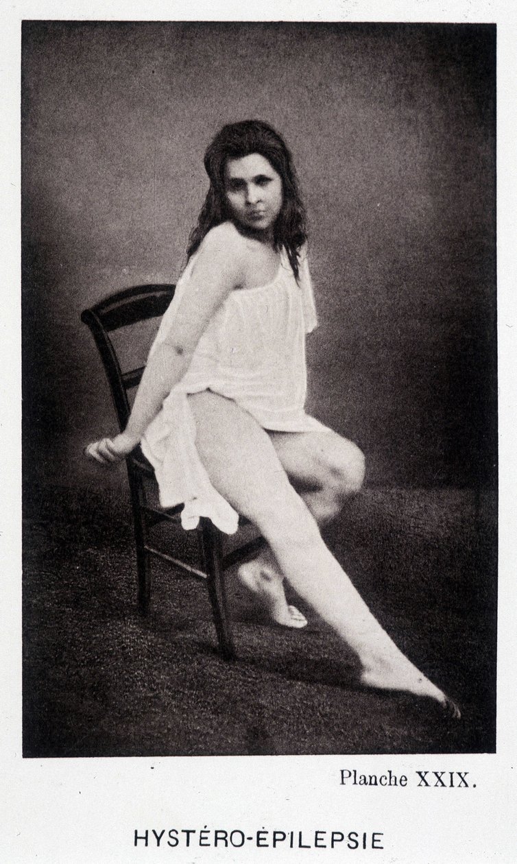 Hystero Epilepsie - Contracture in "" أيقونية فوتوغرافية لـ Salpétrière: service of Mr. Charcot "بقلم بول ريجنارد وبورنفيل بواسطة فنان غير معروف