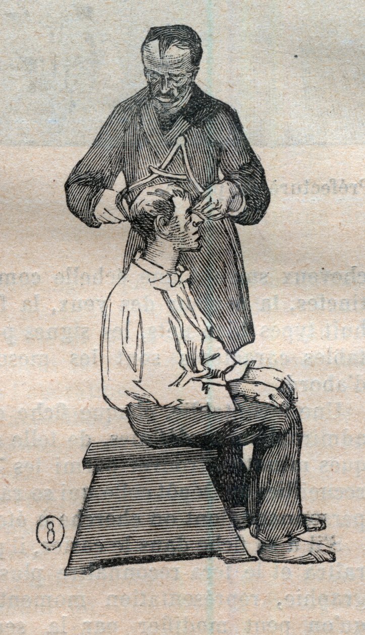 قياس الأنثروبومترية القضائية أو Bertillonage ، طريقة ألفونس بيرتيلون (1853-1914): قياس القطر العرضي للجمجمة - نقش في "" La Science francaise " بواسطة فنان غير معروف