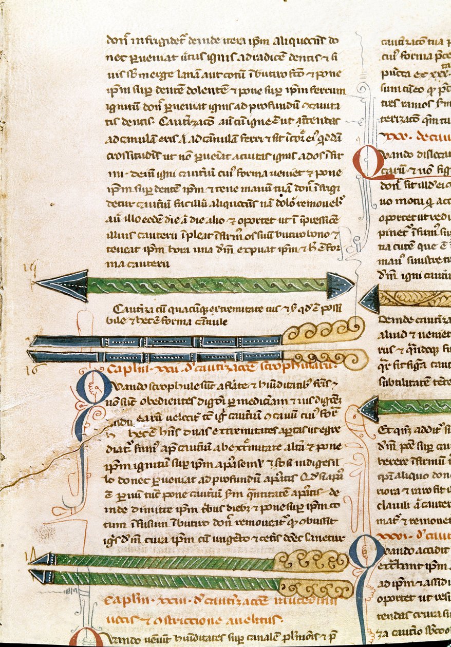 صفحة المخطوطة "الجراحة" (MS. LAT.VII 32-3023) بقلم Guillaume de Salicet (Guglielmo da Saliceto) (1207-1270) الراهب والطبيب. القرن الرابع عشر البندقية مكتبة مارسيانا بواسطة فنان غير معروف