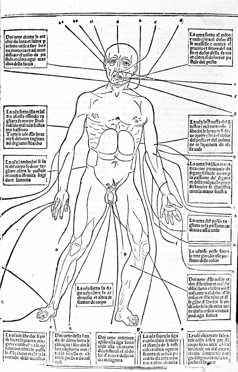 هذه الصورة توضح اماكن الجسم او ممارسة النزيف حسب الالم. رسالة في الطب لجيرولامو كاردانو (كاردانوس هيرونيموس) ، فلورنسا بواسطة فنان غير معروف