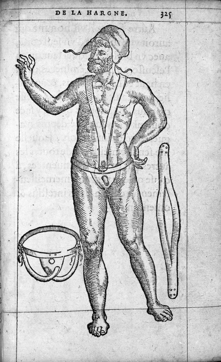 الطب: حزام فتق. نقش من "" De la hargne "للطبيب والجراح الفرنسي Ambroise Pare (1509-1590) من القرن السادس عشر بواسطة فنان غير معروف
