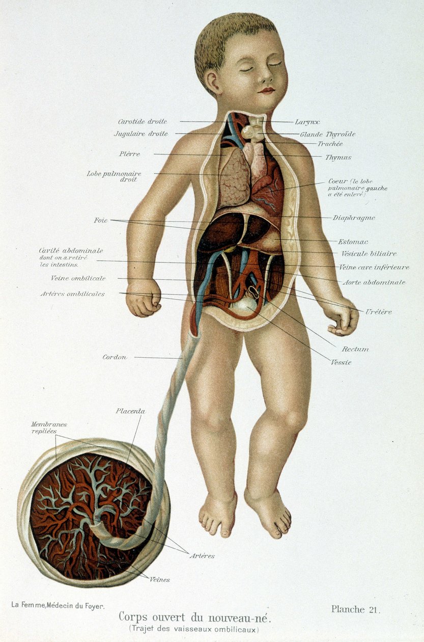 Medicine: newborn (skinned in the bust). بواسطة فنان غير معروف