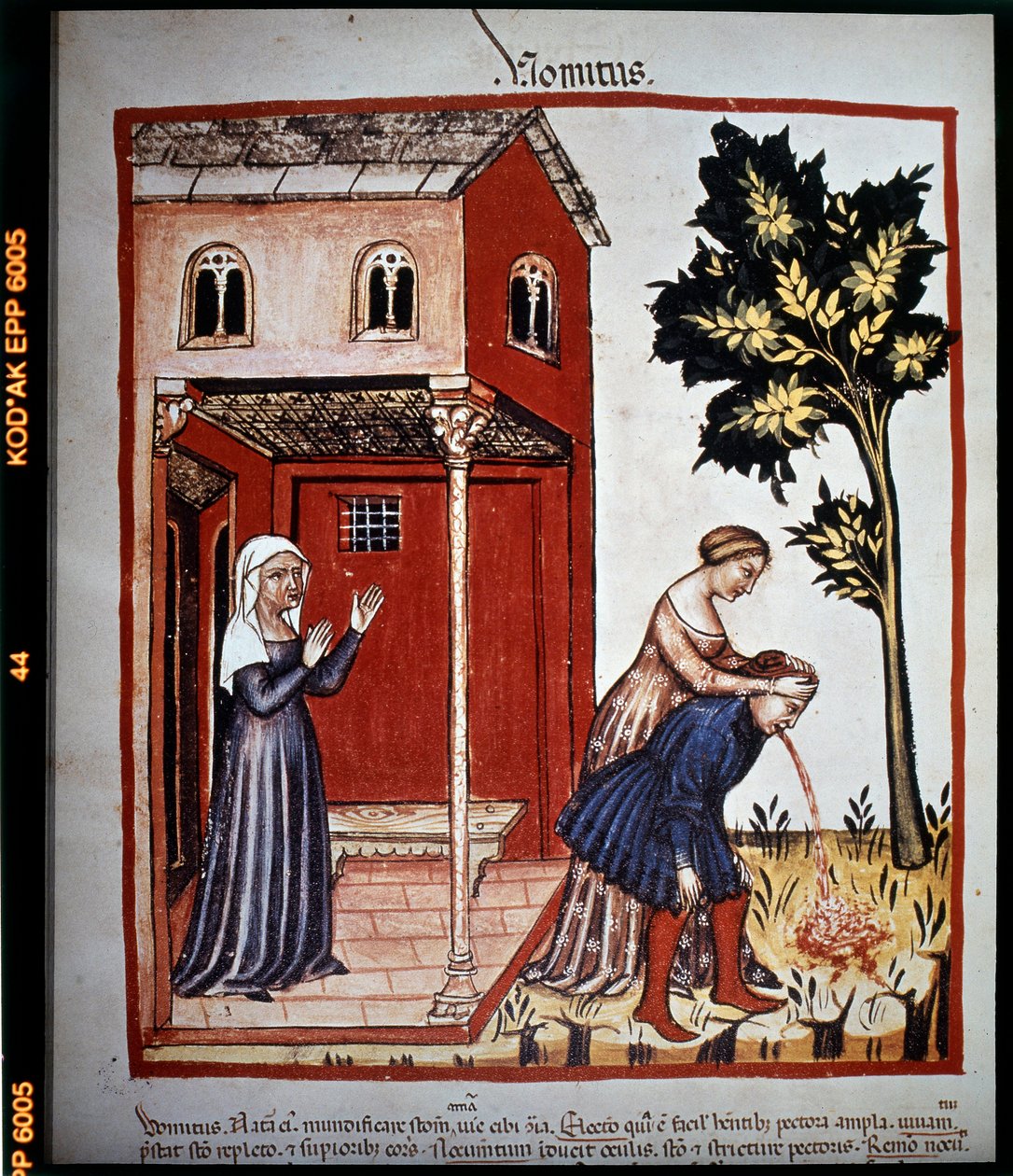 رسالة في الطب "Tacuinum sanitatis" من القرن الرابع عشر: القيء. ب ، فيينا. بواسطة فنان غير معروف