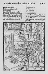 The Book of Cirurgia by Hieronymus Brunschwig (litho)