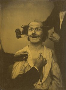 تعبير خاطئ وغير مكتمل عن مفاجأة أو إعجاب مقبول ، 1854-1856 ، طُبع عام 1862. بواسطة دوشين دي بولوني