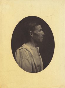 صورة شخصية لرجل يبلغ من العمر 42 عامًا ، أذهله تعاطي الكحول ... 1854-1856. بواسطة دوشين دي بولوني