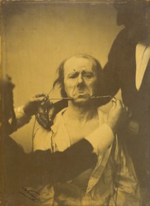 الألم واليأس ، 1854-1856 ، طُبع عام 1862. بواسطة دوشين دي بولوني