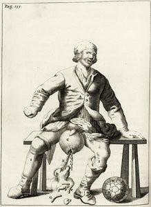 تصريف السوائل من القيلة الصفنية ، من التمارين العملية لعلاج الطريقة بواسطة فريدريك ديكرز ، 1694 بواسطة المدرسة الهولندية