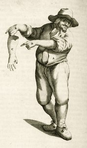 إزالة الجلد الميت بالبثرات ، من التمارين العملية لعلاج الطريقة بواسطة فريدريك ديكرز ، 1694 بواسطة المدرسة الهولندية