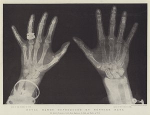 Royal Hands reproduced by Rontgen Rays (engraving) بواسطة مدرسة اللغة الإنجليزية