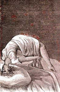 الهستيريا والاضطراب النفسي والعصبي الناتج عن القلق الشديد. 1887 (نقش) بواسطة المدرسة الفرنسية