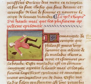 السيدة 22532 مريض يعاني من نوبة صرع ، من Le Livre des Proprietes des choses بواسطة Barthelemy lAnglais ، c. 1410-15 بواسطة المدرسة الفرنسية