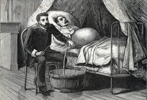مريض بتليف كبدي متقدم ، طبيب يقوم بعمل ثقب (نقش) 1888 بواسطة المدرسة الفرنسية