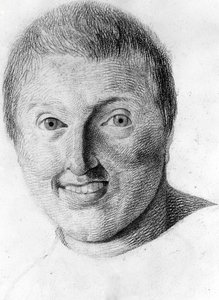 An epileptic, -in “Etude de la physiognomy des alienés”, drawing by Gabriel