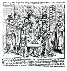 الختان ، من "ليبر كرونيكاروم" بقلم هارتمان شيدل (1440-1514) بواسطة المدرسة الألمانية