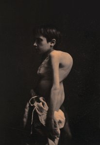 صورة لصبي الحدباء ، 1855-57 بواسطة Guillaume Benjamin Armand Duchenne de Boulogne
