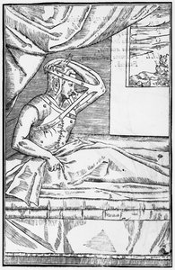 جراحة ترميمية على الأنف ، رسم توضيحي من De curtorum chirurgia per insitionem بواسطة Gaspare Tagliacozzi (1545-99) البندقية ، تم نشره عام 1597 بواسطة المدرسة الايطالية