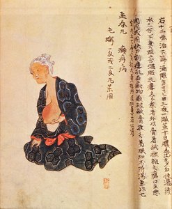 أول علاج جراحي لسرطان الثدي يتم تحت التخدير العام بواسطة Seishu Hanaoka (1760-1836) عام 1804 بواسطة المدرسة اليابانية