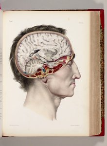 صورة حجرية ملونة باليد لرأس مشوهة في الملف الشخصي تظهر الدماغ ، من "Traite Complet de l Anatomie de l&39;Homme، Comprendre la Medicine Operatoire" ، 1831-54