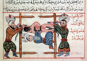 الحد من الكسر. صورة مصغرة من علاج الطب التركي لشرف الدين بواسطة المدرسة العثمانية