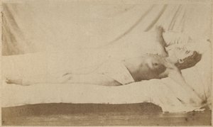 الصرع الهستيري ، الهجوم ، الصلب ، اللوحة السادسة من "Iconographie Photographique de La Salpetriere" بورنفيل و ب. ريجنارد ، باريس ، 1876 (طبعة زيلية)