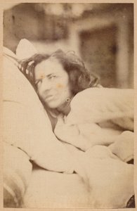 الصرع الهستيري ، الهذيان ، الشهوة ، اللوحة السادسة والثلاثون من "Iconographie Photographique de La Salpetriere" بورنفيل و ب. ريجنارد ، باريس ، 1876 (طبعة زيلية)