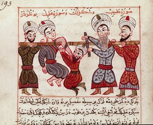 الطب: تدخل العظام. صورة مصغرة مأخوذة من حلب للطب التركي من قبل شرف الدين (شرف الدين) (1404-1468) بعد "لا سيرجي إمبريال" "(السيدة سوب تورك 693 الصحيفة 193) 1466 باريس ، ب. بواسطة المدرسة الفارسية