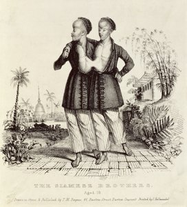 الإخوان السياميون ، البالغون من العمر 18 عامًا ، طبعه تشارلز هولمانديل (1789-1850) ، عام 1829 بواسطة توماس مان باينز