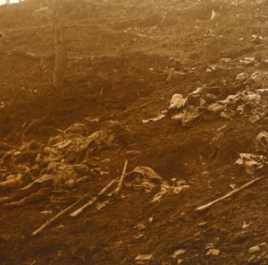 بعد الهجوم ، Les Éparges ، شمال فرنسا ، 1915. بواسطة غير معروف