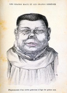 كريتين يبلغ من العمر 15 عامًا ، 1890 بواسطة غير معروف
