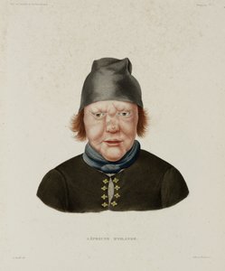 Diseases, Leprosy Female leper, Iceland, early 19th century بواسطة غير معروف