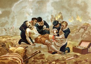 يمارس Ambroise Pare Medicin والجراح الفرنسي (1509-1590) ربط الشرايين بعد البتر. بعد احتفالات hombres y Mujeres. برشلونة 1877. بواسطة فنان غير معروف