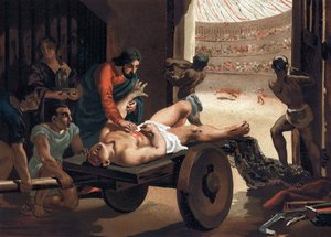 كلود جالين (كلاوديوس جالينوس أو كلاوديو جالينو أو كلاوديوس جالينوس أو جالينوس ، ص 131 - ضد 201) ، طبيب يوناني يعالج مصارعًا. برشلونة 1881 بواسطة فنان غير معروف