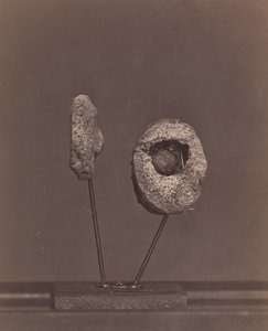 مفصل الركبة المقطوع. كرة مسكيت مستديرة في اللقمة الداخلية لعظم الفخذ الأيمن [غاردين ... ، 1866-1867. بواسطة ويليام اتش بيل