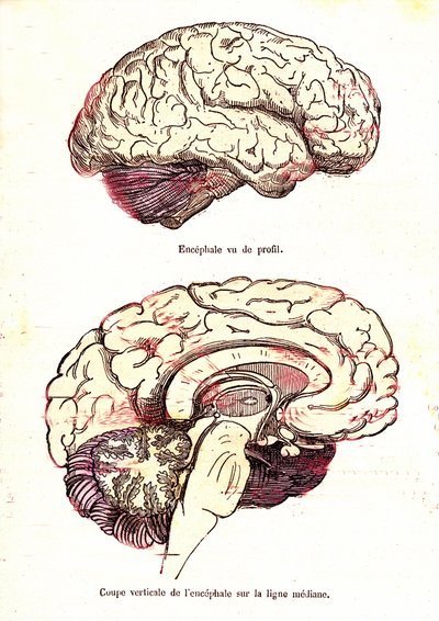 L#39;encephalus (الحياة الطبيعية والصحة لـ J. Rengade) - شكل دو توب: عرض الملف الشخصي. الشكل 2: القطع العمودي. رسم أ. ديمارل 1881 بواسطة ألفونس ديمارلي