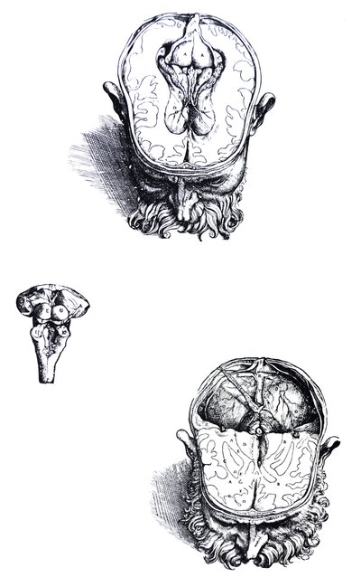 لوحات من الكتاب السابع من De Humani Corporis Fabrica بواسطة أندرو فيزاليوس