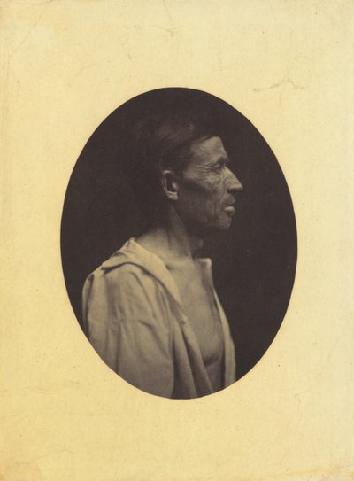 صورة شخصية لرجل يبلغ من العمر 42 عامًا ، أذهله تعاطي الكحول ... 1854-1856. بواسطة دوشين دي بولوني