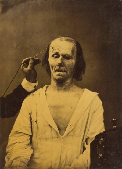 وجه مسترخي يسار ، انتباه عميق يمين ، 1854-1856 ، مطبوع عام 1862. بواسطة دوشين دي بولوني
