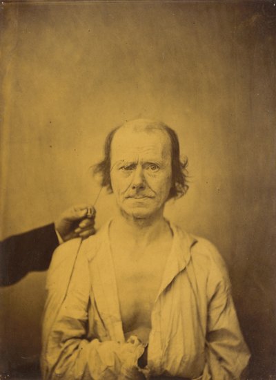 يسار الانتباه ، انعكاس يمين ، 1854-1856 ، مطبوع عام 1862. بواسطة دوشين دي بولوني